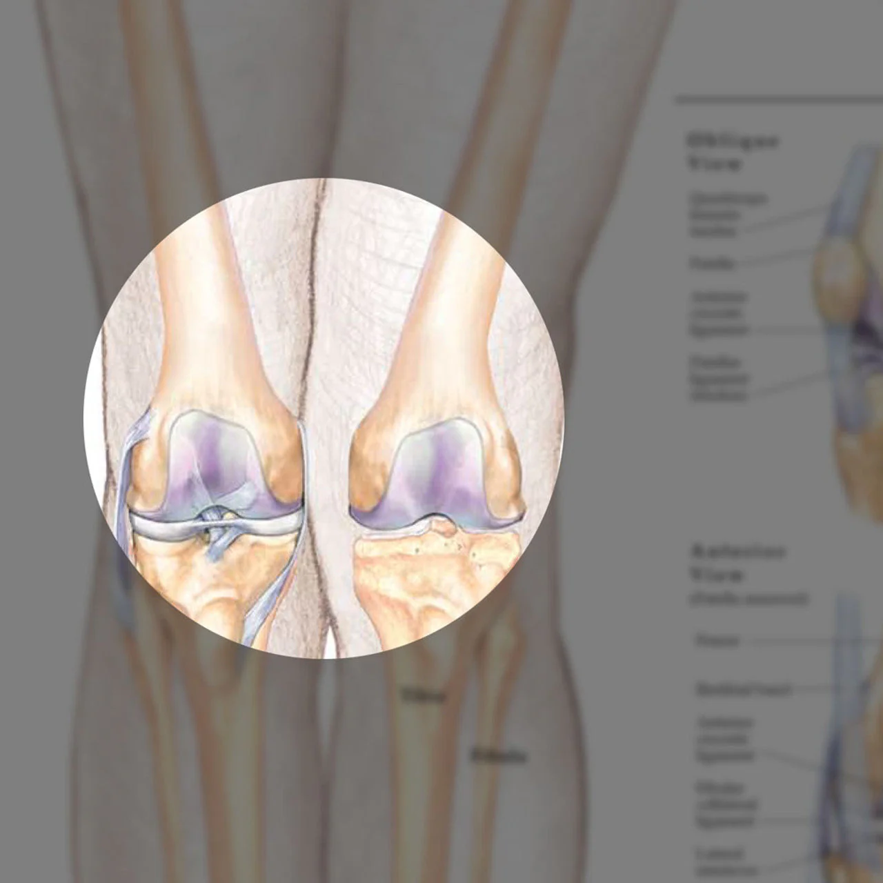 Hip & Knee ( Laminated) - Image 2